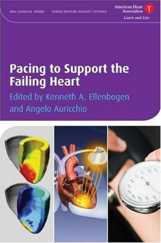 Pacing to Support the Failing Heart (American Heart Association Clinical Series)