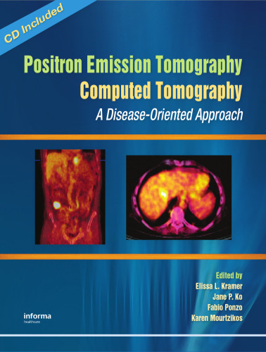 Positron Emission Tomography-Computed Tomography:: A Disease-Oriented Approach