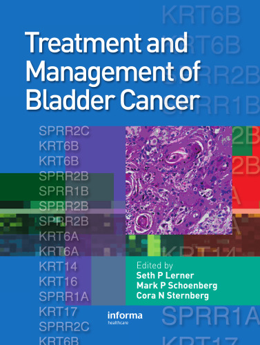 Treatment and Management of Bladder Cancer