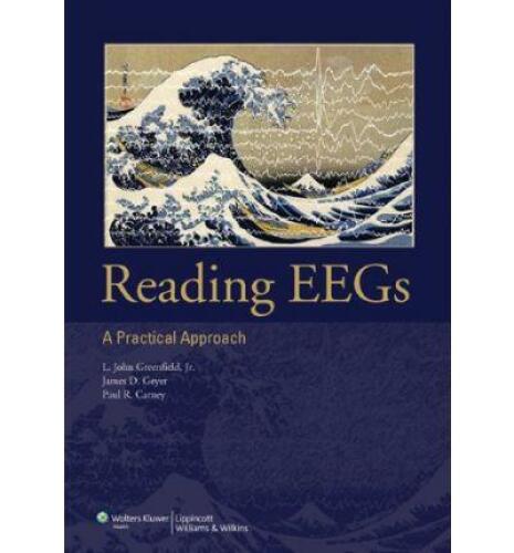 Reading EEGs: A Practical Approach