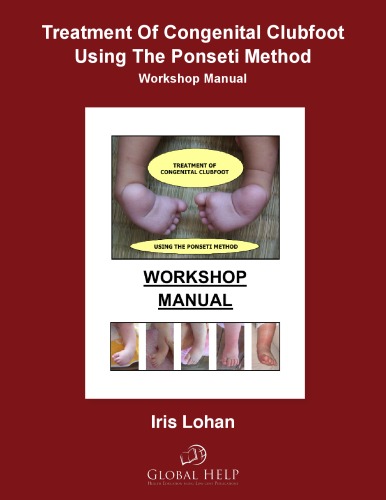 Treatment Of Congenital Clubfoot Using The Ponseti Method: Workshop Manual