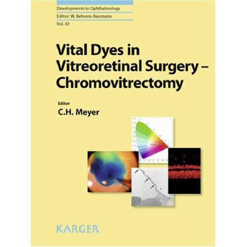 Vital Dyes in Vitreoretinal Surgery: Chromovitrectomy (Developments in Ophthalmology, Vol. 42)