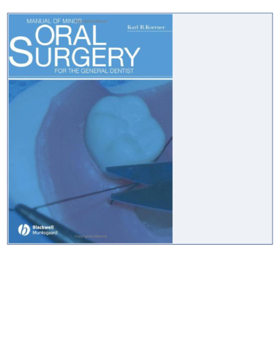 Manual of Minor Oral Surgery for the General Dentist