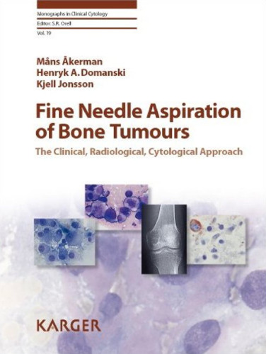 Fine Needle Aspiration of Bone Tumours: The Clinical, Radiological, Cytological Approach (Monographs in Clinical Cytology Vol 19)