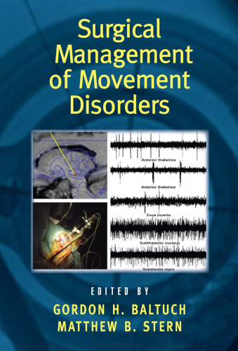 Surgical Management of Movement Disorders (Neurological Disease and Therapy)