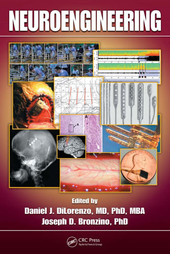 Neuroengineering