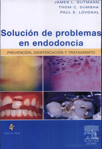 Solucion de Problemas En Endodoncia