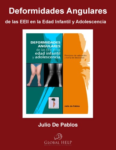 Deformidades Angulares de las EEII en la Edad Infantil y Adolescencia