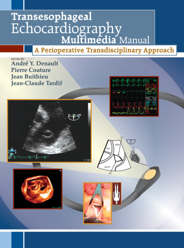 Transesophageal Echocardiography Multimedia Manual: A Perioperative Transdisciplinary Approach