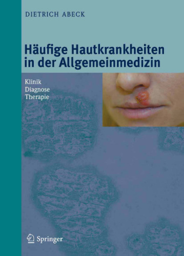 Häufige Hautkrankheiten in der Allgemeinmedizin: Klinik, Diagnose, Therapie