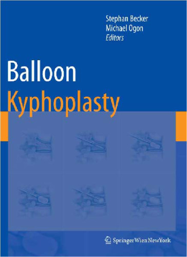 Balloon Kyphoplasty