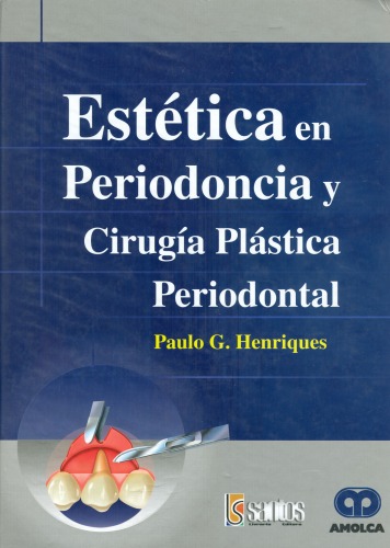 Estética en periodoncia y cirugía plástica periodontal