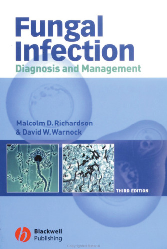 Fungal Infection: Diagnosis and Management (2003)