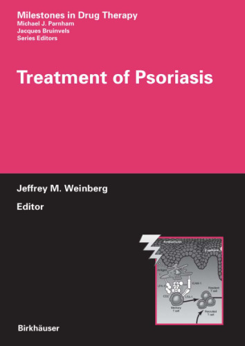 Treatment of Psoriasis (Milestones in Drug Therapy)