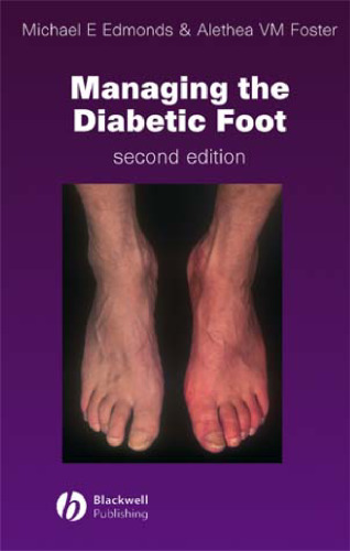 Managing the Diabetic Foot