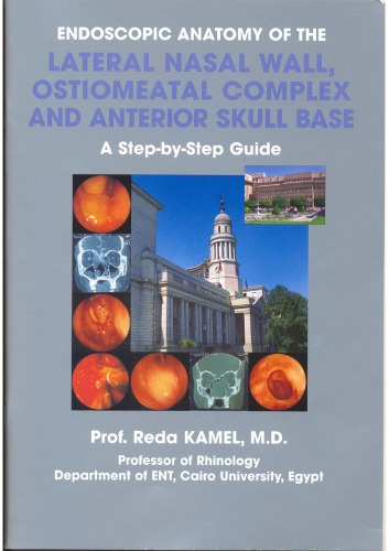 Endoscopic Anatomy of the Lateral Nasal Wall, Ostiomeatal Complex and Anterior Skull Base: A Step-by-Step Guide