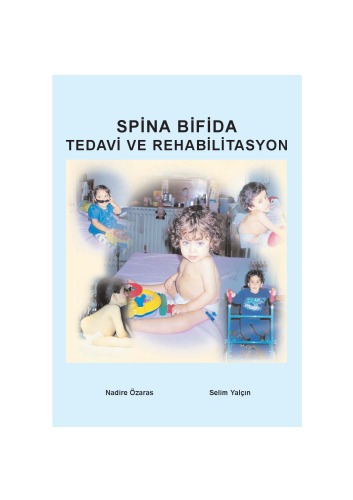 Spina Bifida: Tedavi VE Rehabilitasyon