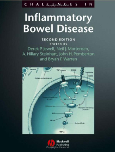 Challenges in Inflammatory Bowel Disease , 2nd edition