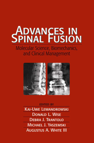 Advances in Spinal Fusion: Molecular Science, Biomechanics, and Clinical...