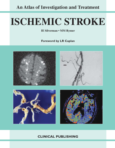 Ischemic Stroke: An Atlas of Investigation and Treatment (Atlases of Investigation and Management)