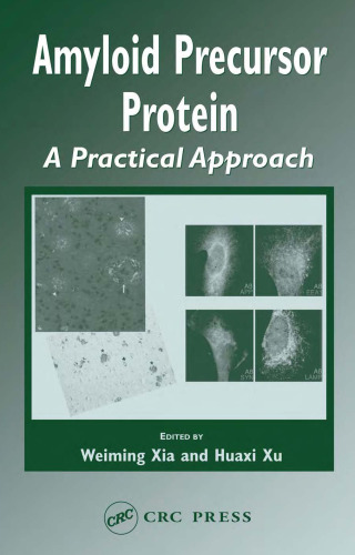 Amyloid Precursor Protein: A Practical Approach