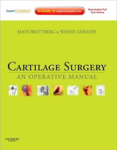 Cartilage Surgery: An Operative Manual, Expert Consult: Online and Print