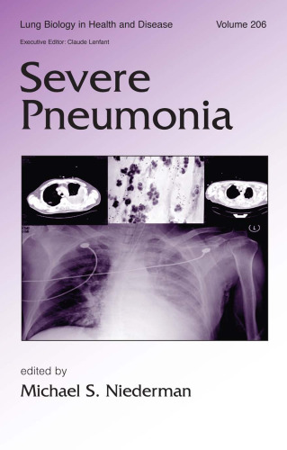 Severe Pneumonia (Lung Biology in Health and Disease, Volume 206)