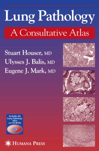 Lung Pathology: A Consultative Atlas