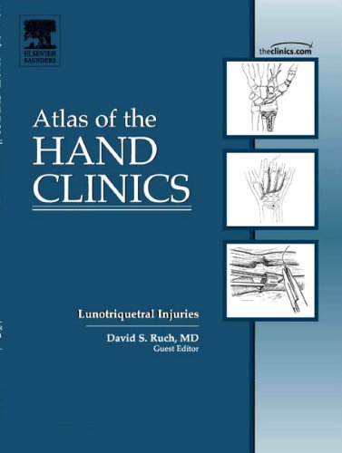 Rheumatoid Arthritis of the Wrist, An Issue of Atlas of the Hand Clinics (The Clinics: Orthopedics)