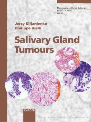 Salivary Gland Tumours: Monographs in Clinical Cytology  