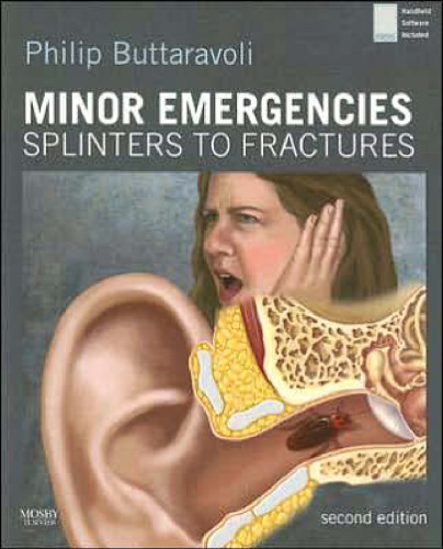 Minor Emergencies  