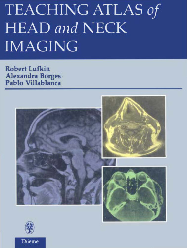 Teaching Atlas of Head and Neck Imaging  