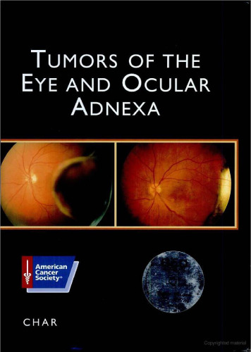 Tumors of the Eye and Ocular Adnexa (Atlas of Clinical Oncology)