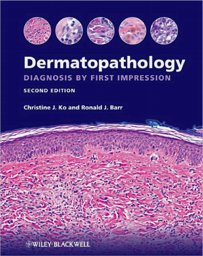 Dermatopathology: Diagnosis by First Impression, 2nd Edition  