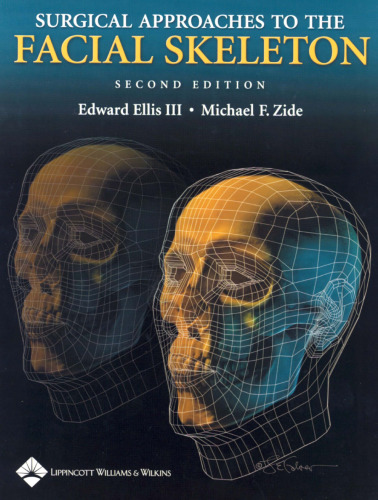 Surgical Approaches to The Facial Skeleton, Second Edition  