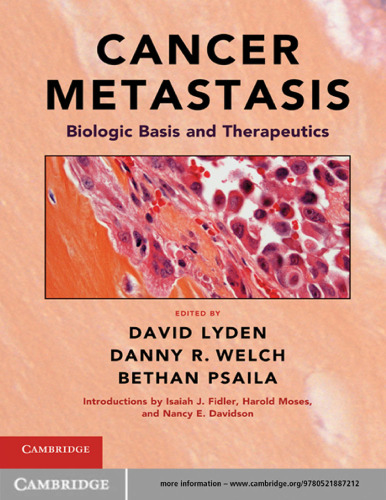 Cancer Metastasis: Biologic Basis and Therapeutics  