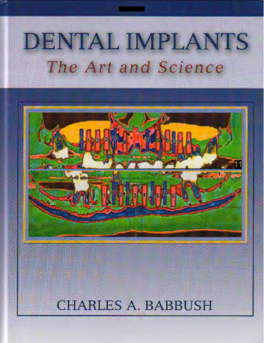 Dental Implants: The Art and Science  