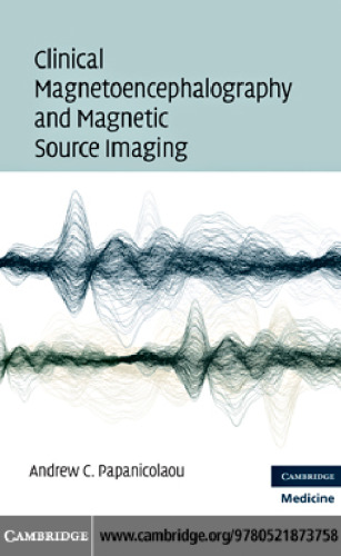 Clinical Magnetoencephalography and Magnetic Source Imaging  