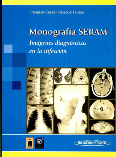 Monografia SERAM: Imagenes Diagnósticas en la Infeccion  