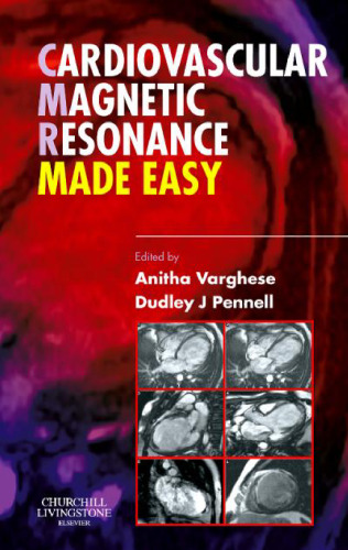 Cardiovascular Magnetic Resonance Made Easy  