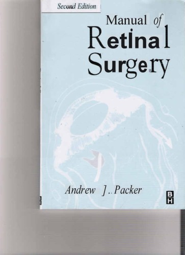 Manual of Retinal Surgery  