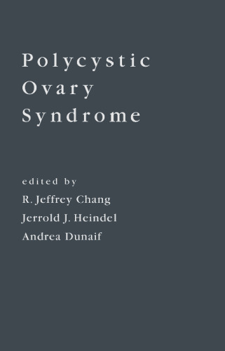 Polycystic Ovary Syndrome  