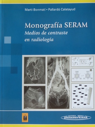 Monografia SERAM: Medios de Contraste en Radiología