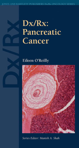 Dx Rx: Pancreatic Cancer ()