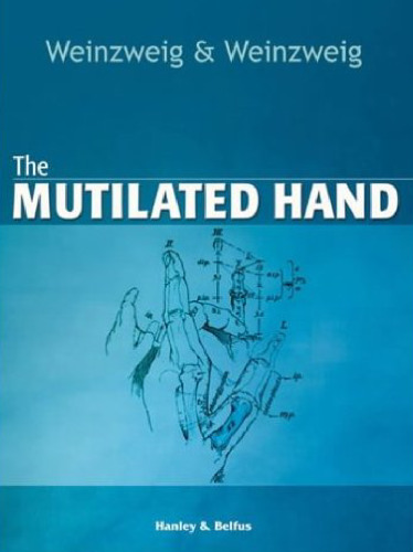 The Mutilated Hand  