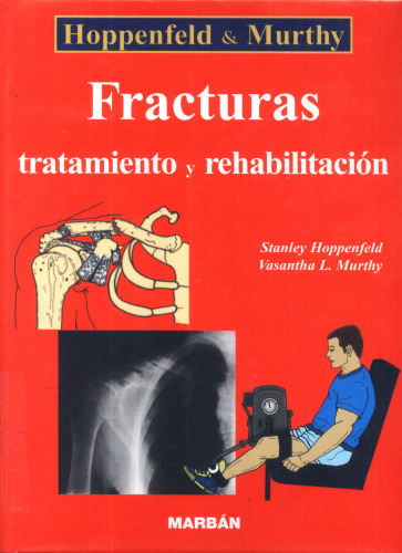 Fracturas: tratamiento y rehabilitación  