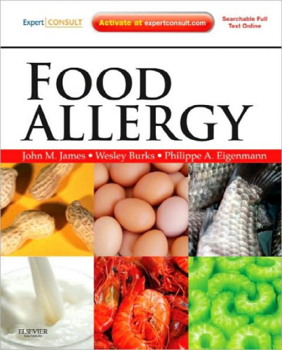 Food Allergy: Expert Consult Basic  