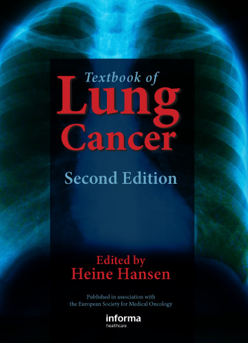 Textbook of Lung Cancer, Second Edition  