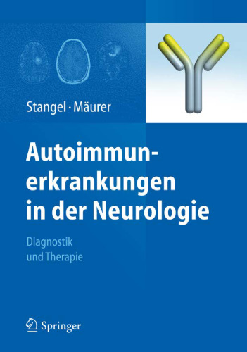 Autoimmunerkrankungen in der Neurologie: Diagnostik und Therapie  