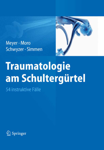 Traumatologie am Schultergürtel: 54 instruktive Fälle  